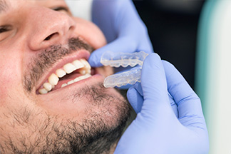 h-whitening.jpg