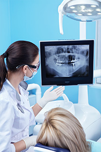 v-xray.jpg